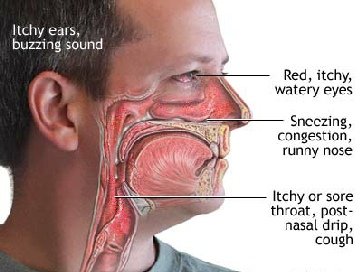 Symptoms Of Black Mold