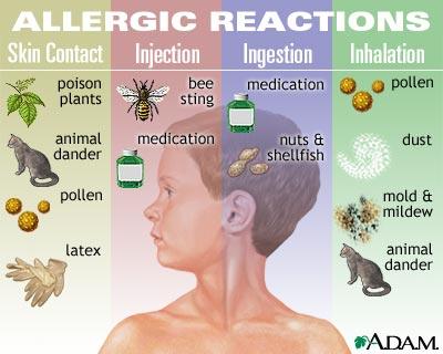 Mold Allergies In Children